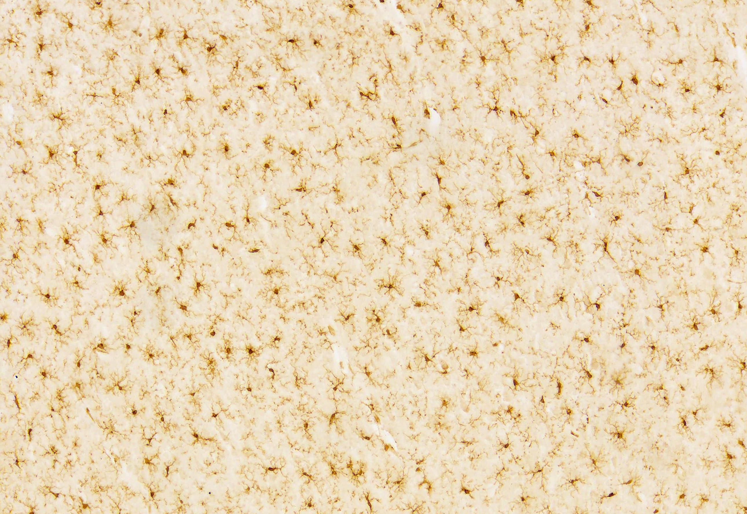 IHC Tissue Sample